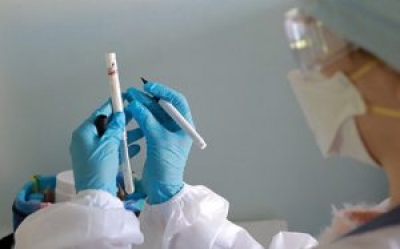 В Беларуси проведено более 30 тыс. тестов на коронавирус